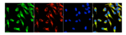 図2　ヒト子宮頸がんHeLa細胞表面のサリューシンβとATP合成酵素β鎖の共在.png