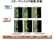 コラーゲンスコア結果（写真）訂正版.png