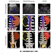 【図２】超音波検査と造影CT検査（大学プレスセター掲載用）.jpg