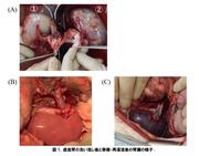 【図１】虚血腎の洗い流し後と移植・再灌流後の腎臓の様子（大学プレスセター掲載用）.jpg