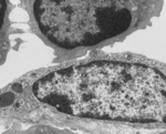 リンパ管壁のタンパク質分解が全身の免疫バランスに波及する -- 新たな血管保護の仕組みを解明 --