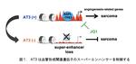 【東京医科大学】がんにおける新たな血管新生機構を発見　～ 肉腫の融合遺伝子とその標的分子の機能を明らかにする ～