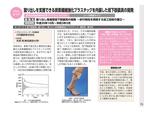 東京家政大学米津亮教授の研究成果が科学技術振興機構「A-STEP成果集」に掲載 -- 歩行時の蹴りだしをサポートする短下肢装具を開発