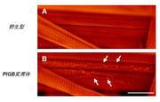 図4. ショウジョウバエ幼虫の筋肉。野生型（A）では秩序だった筋組織が形成されているが、PIGB変異体（B）では筋組織の断裂が認められる（矢印）。.jpg