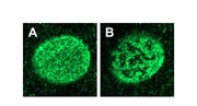 図2. 野生型では均一に分布する核膜蛋白質（核膜孔複合体、A）が、PIGB変異体ではまだらになっている（B）.jpg