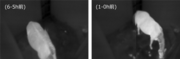 3_分娩前6-5時間と1-0時間の体表面温度の比較.png