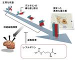 脊髄小脳失調症の新しい治療薬候補を発見　～L-アルギニンの脊髄小脳失調症6型に対する治験結果～