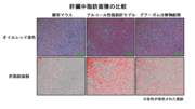 肝臓中脂肪面積の比較.png
