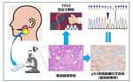  【東京医科大学】高悪性度唾液腺癌の予後因子となる新規のがん抑制遺伝子発現様式を発見 ～多施設共同研究によるp53タンパク細胞質発現パターンとTP53遺伝子変異の相関を解明～