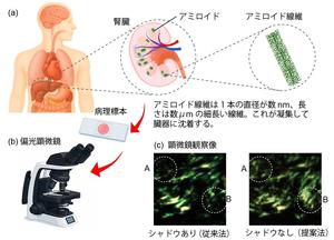 【埼玉医科大学・宇都宮大学】「影のない画像」でアミロイドーシスを鮮明に診断！ ～ 新技術で複屈折を定量化、従来法を超える画像を実現