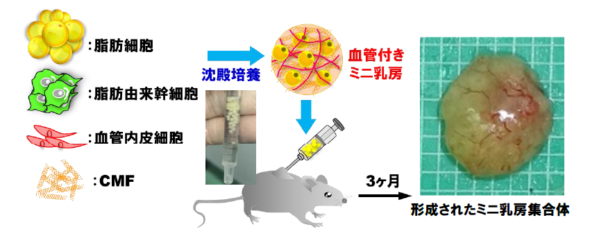 世界初、高い生着率の血管付きミニ乳房を再構築 -- インプラント等に代わる新たな乳房再生医療へ期待 -- 大阪大学