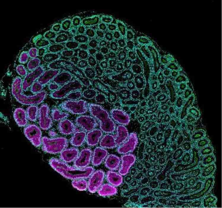 ［大阪大学］精子の成熟を調節する鍵分子を発見 -- 不妊症の原因究明と治療に新たな視点