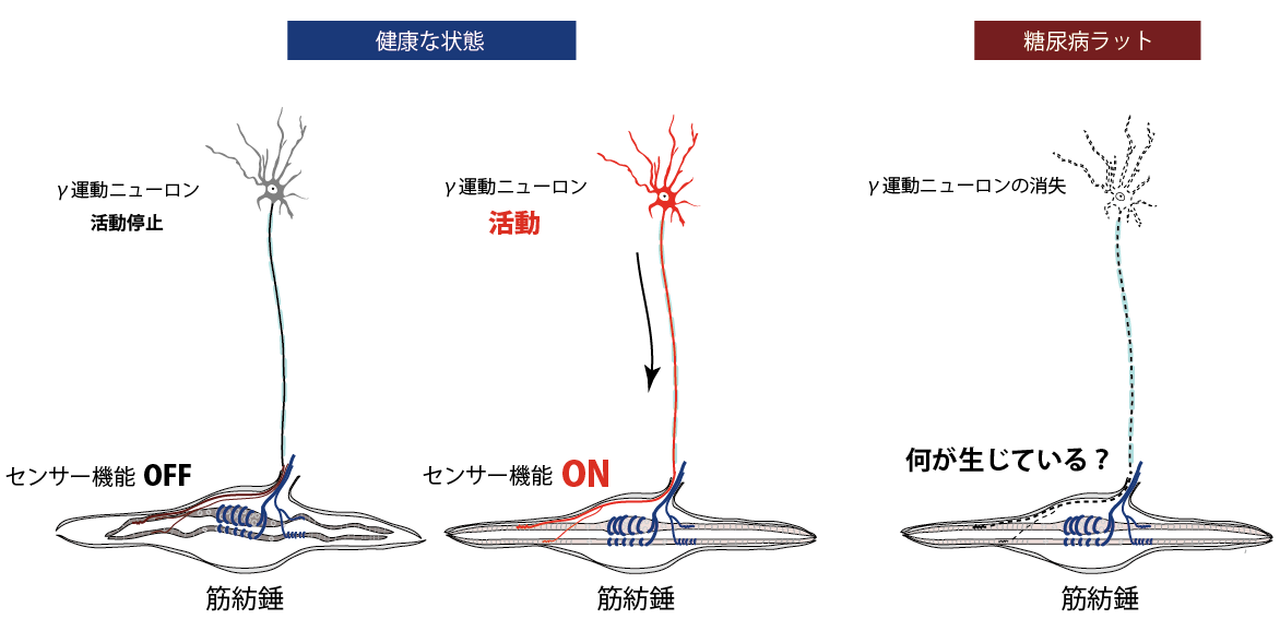 健康科学大学理学療法学科の村松憲准教授らが糖尿病性神経障害による転倒リスク上昇のメカニズムの一部を解明 -- 糖尿病性神経障害の新たな治療対象の存在を示す