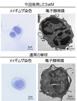 難病 “線維症”の発症原理の一端を解明 -発症に関与する細胞SatMを発見、これを標的に新規薬開発に期待- 大阪大学