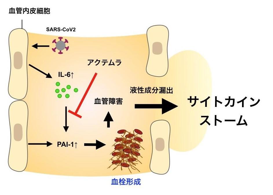 新型コロナウイルス感染性肺炎の重症化抑制の仕組みを解明 -- IL-6を抑えて血管障害因子の産生を抑制する -- 大阪大学