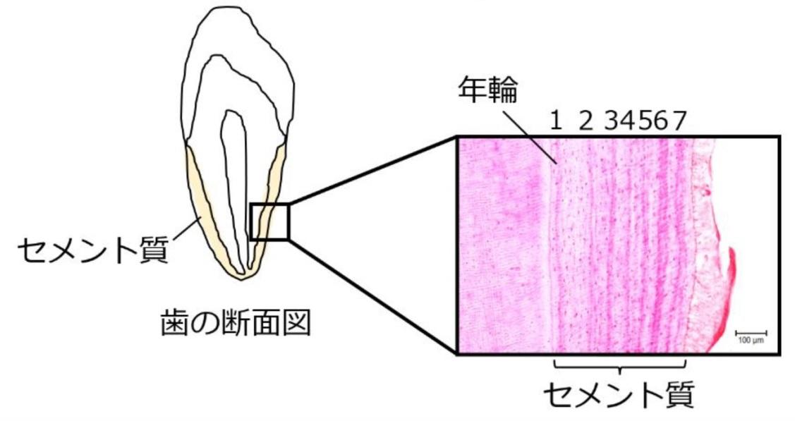 クマも子育ては大仕事～歯が語る出産・育児の履歴～