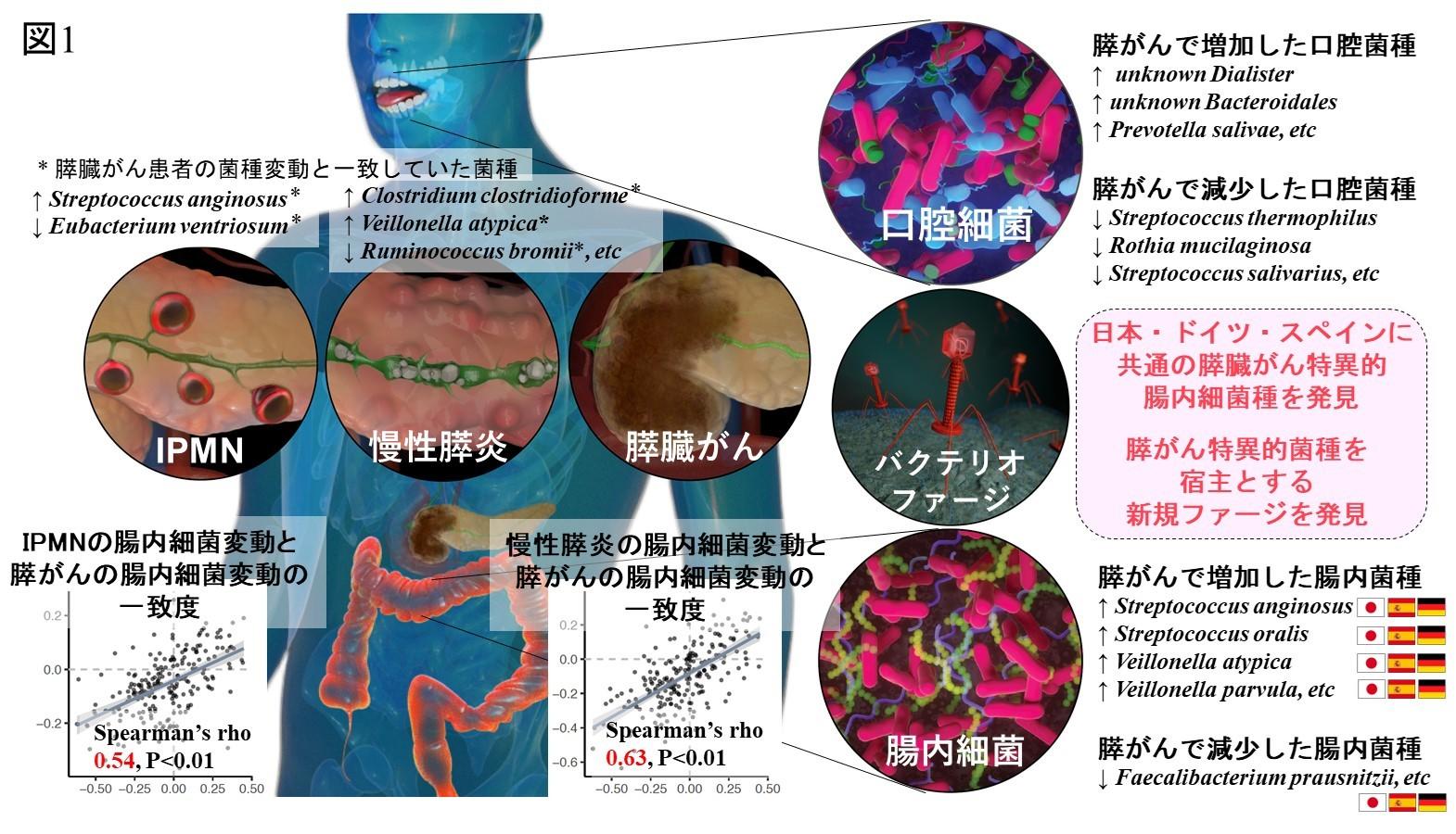 東京医科大学が「膵臓がんや予後と関連する口腔内細菌・腸内細菌種を発見　～膵がんの早期発見等のための新たな腫瘍マーカーの可能性～」