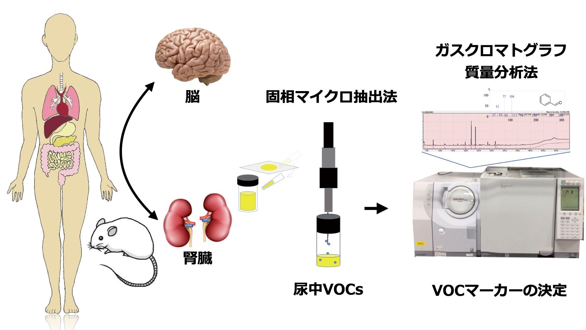 【京都産業大学】高齢者のうつ・不安症バイオマーカーの発見--英国科学雑誌「Discover Mental Health」（オンライン版）に掲載