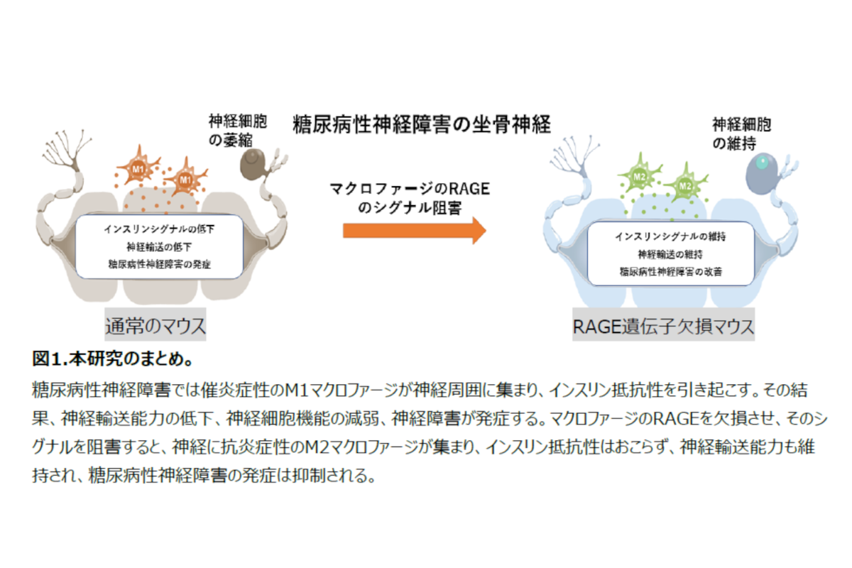 【弘前大学】糖尿病性神経障害の新規発症機序の解明について～未だ根治的治療法がない糖尿病性神経障害の新規治療法の確立に期待～