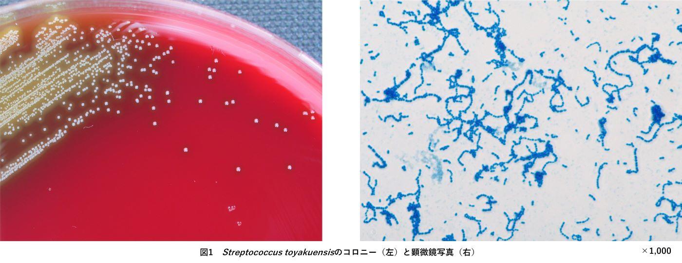 多剤耐性を示すレンサ球菌の新種発見！ -- Streptococcus toyakuensisと大学ドメイン名を命名 --
