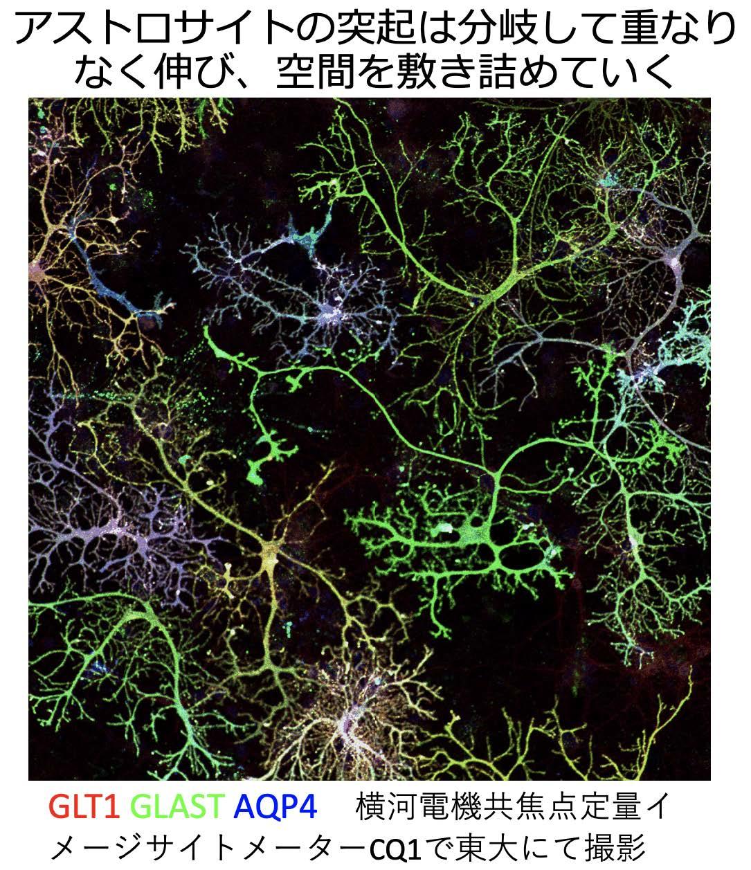 神経細胞への栄養輸送に関わるアストロサイトの分岐形成過程を明らかに -- 昭和女子大学