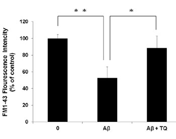 「チモキノン」がアルツハイマー病に有効であることを発見――東京工科大学応用生物学部