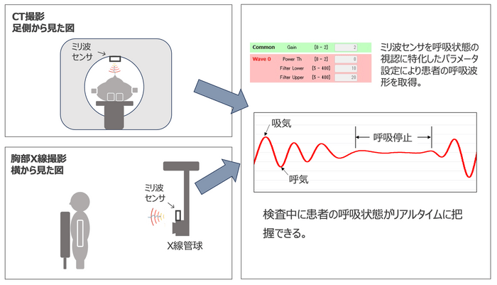 世界初！胸部X線撮影やCT検査時の呼吸状態を非接触で計測　ミリ波センサを用いた新たなモニタリングシステムを開発