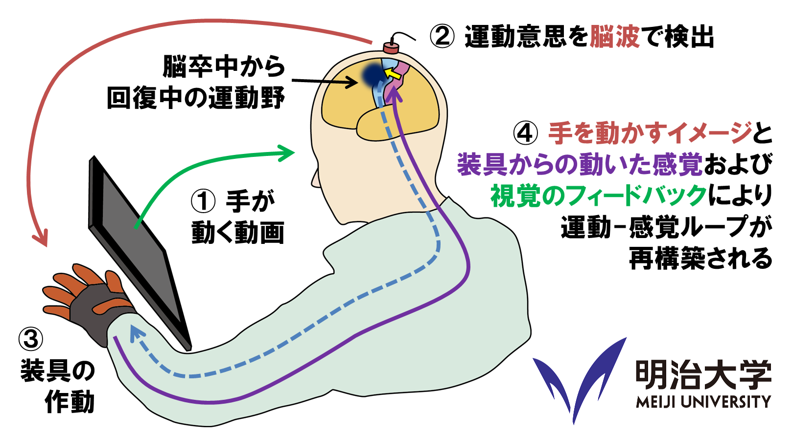 明治大学理工学部の小野弓絵准教授と穂翔会村田病院が脳卒中リハビリテーション技術を開発 -- 麻痺した手を動かすために