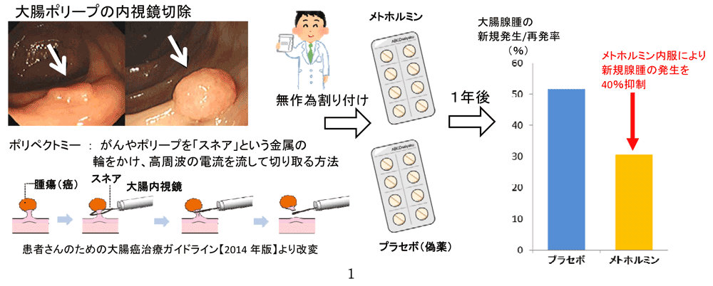 横浜市立大学が糖尿病の治療薬メトホルミンを用いた大腸腫瘍の画期的予防法を開発 -- 世界初報告　大腸ポリープ切除後のがん発症予防の可能性