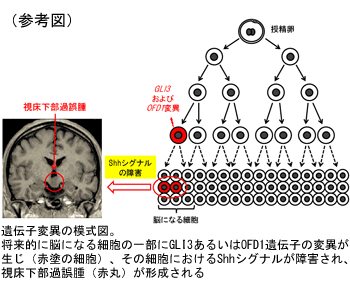 脳になる細胞での突然変異が視床下部過誤腫の原因となることを発見　～形態形成に重要なソニックヘッジホッグシグナルの障害と視床下部過誤腫の関係が明らかに～横浜市立大学