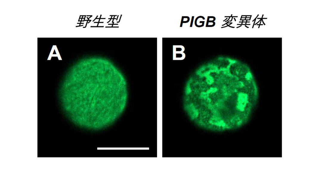 細胞核の多彩な機能を支えるタンパク質の発見―筋ジストロフィーを引き起こすラミノパチーの理解－