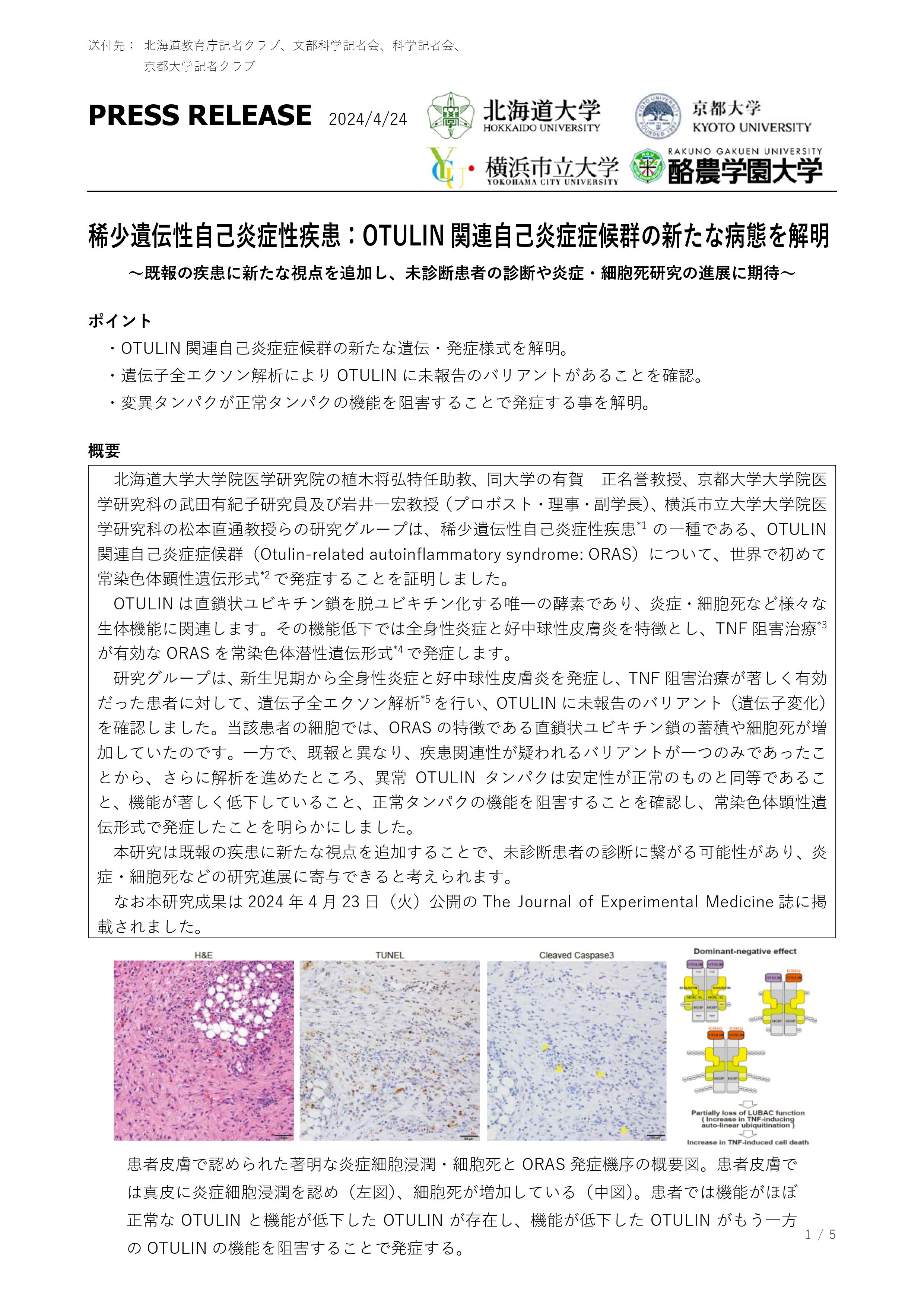 ［プレスリリース：北海道大学、京都大学、横浜市立大学、酪農学園大学］稀少遺伝性自己炎症性疾患：OTULIN関連自己炎症症候群の新たな病態を解明～既報の疾患に新たな視点を追加し、未診断患者の診断や炎症・細胞死研究の進展に期待～