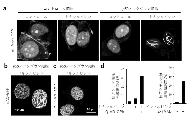 抗がん剤耐性を獲得したがん細胞に対する治療法開発へ期待。がん抑制因子p53の機能低下がもたらす抗がん剤応答への異常を新たに発見。Springer Nature 『Cell Death & Disease』で発表--甲南大学、金沢工業大学