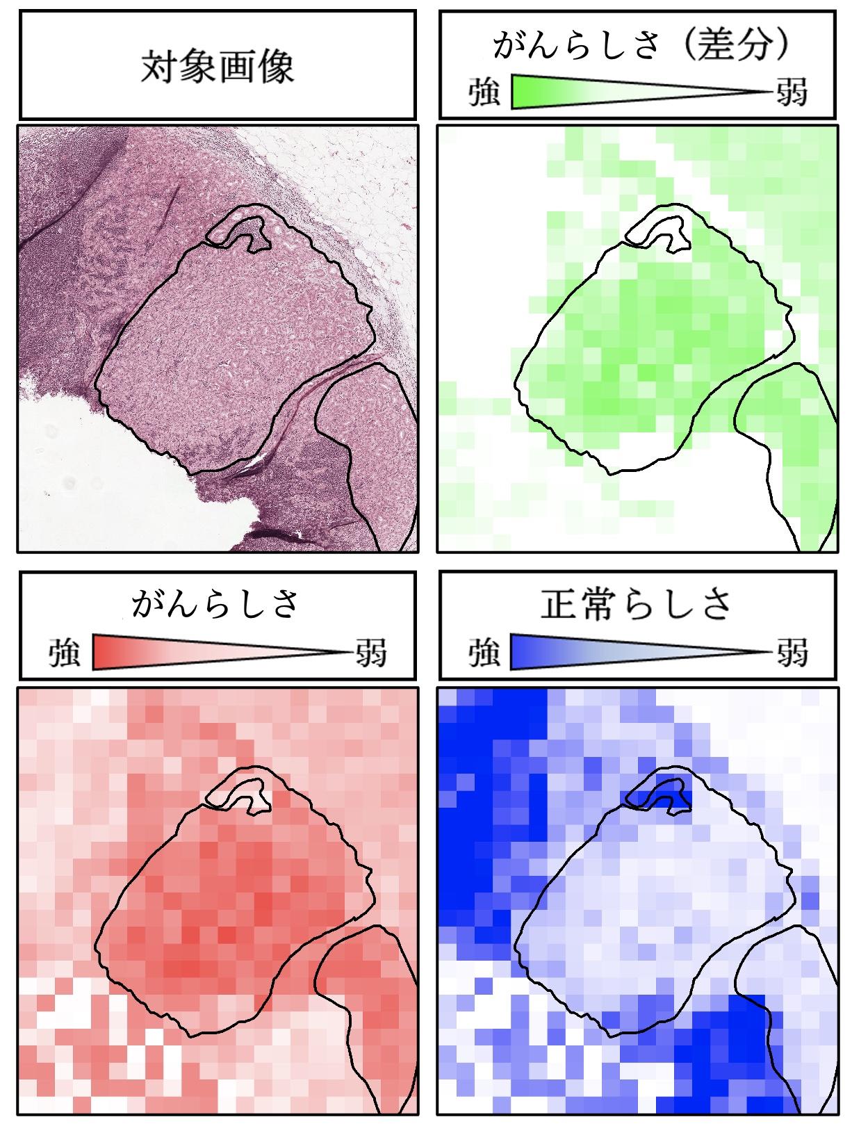 【判断根拠から積み上げる病理画像診断技術実現の可能性を提示】金沢工業大学 金道敏樹教授と金沢医科大学 山田壮亮教授の共著論文が『日本医用画像工学会誌』2022年最優秀論文に選定。2023年7月、田中栄一記念賞が授与されました。