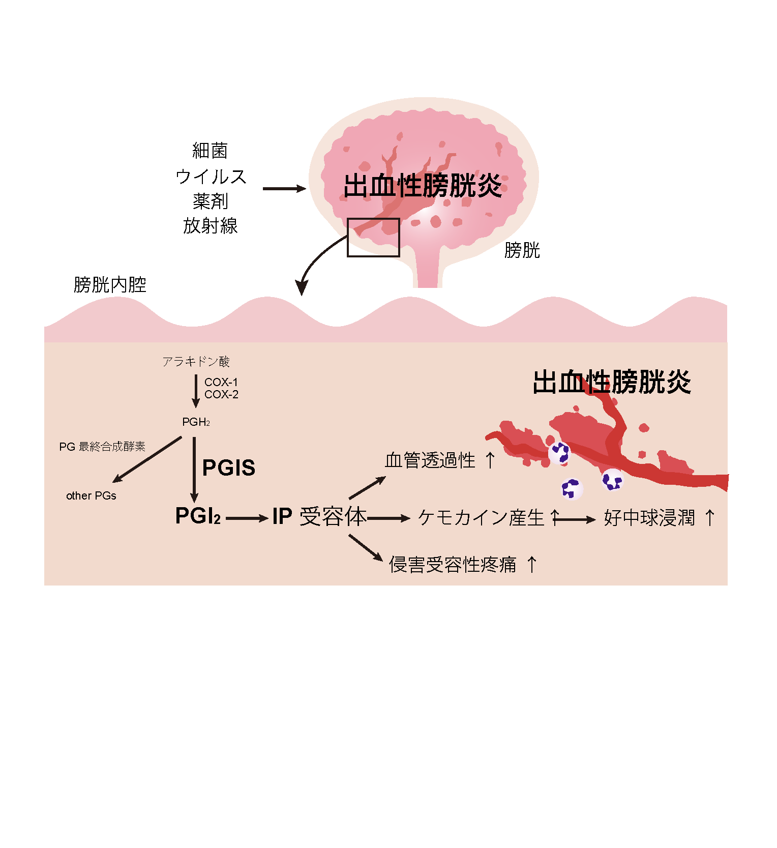 昭和大学らの共同研究グループが出血性膀胱炎の新たな発症機構を解明