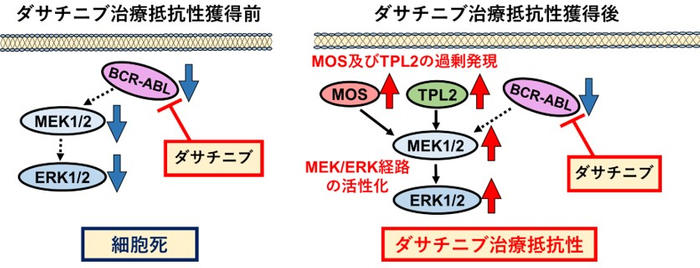 慢性骨髄性白血病治療薬「ダサチニブ」の効果がなくなる（抗がん剤耐性）原因を発見　治療抵抗性患者への新たな治療法開発に期待