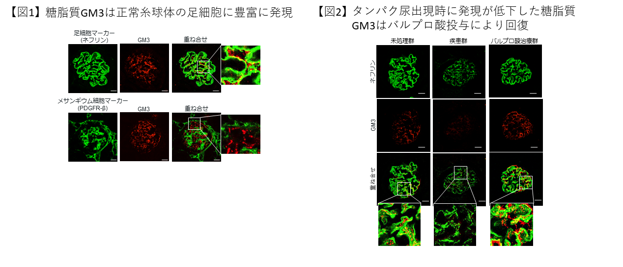 糖脂質(GM3)を標的にしたタンパク尿の新たな治療戦略～透析患者数の減少を目指して～ 北里大学