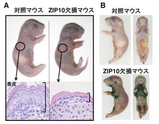 徳島文理大学薬学部の深田俊幸教授らが、アトピー性皮膚炎に関わる新たな分子を発見 -- 体内の亜鉛を運搬するZIP10が関与することを世界で初めて明らかに