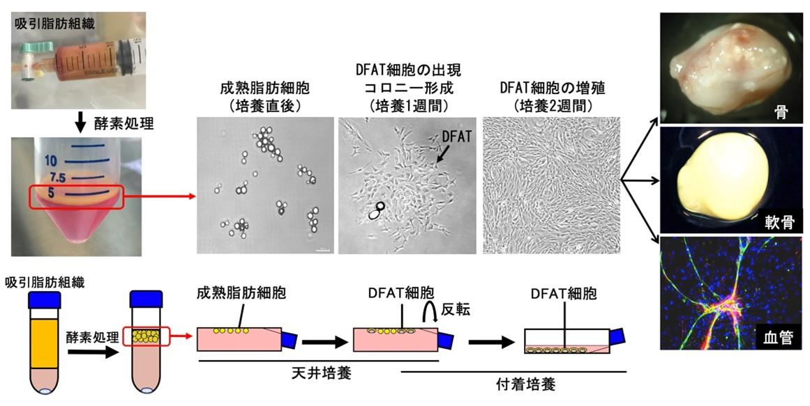 【日本大学】世界初！患者自身の脂肪細胞から作る「DFAT細胞」で変形性膝関節症の細胞治療を開始