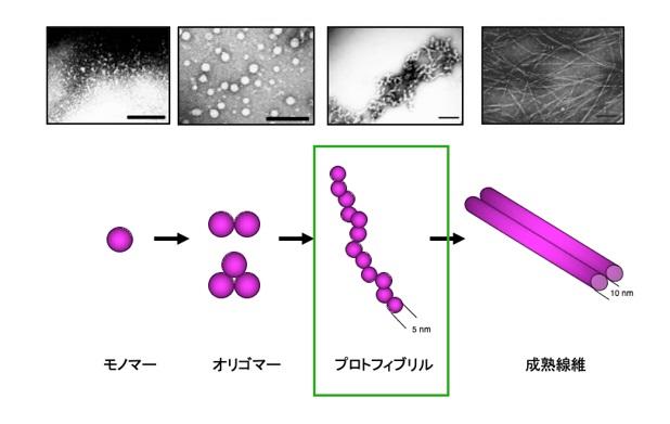 昭和大学などの研究グループがアルツハイマー病の新規治療薬レカネマブの作用機序の一端を解明