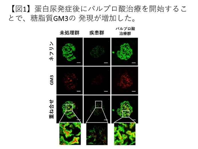 糖脂質を標的にしたタンパク尿治療効果を確認 ～透析患者数の減少を目指して～ 北里大学