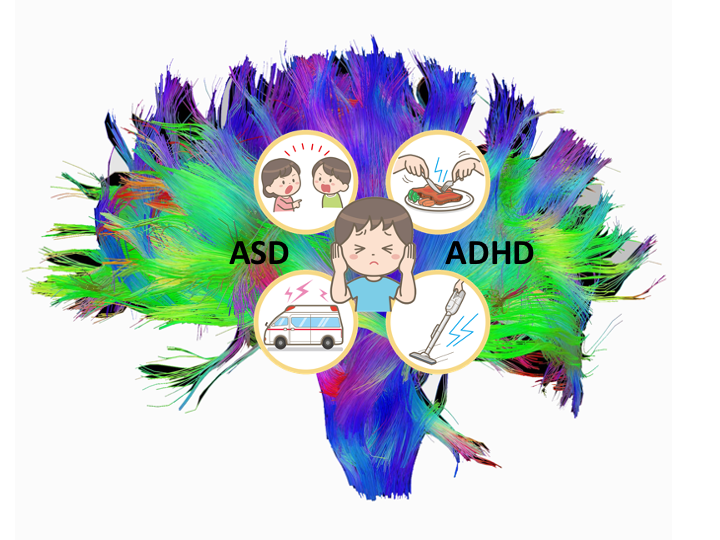 発達障害の感覚過敏の原因は？ 自閉スペクトラム症と注意欠如多動症で共通していた脳内結合の問題