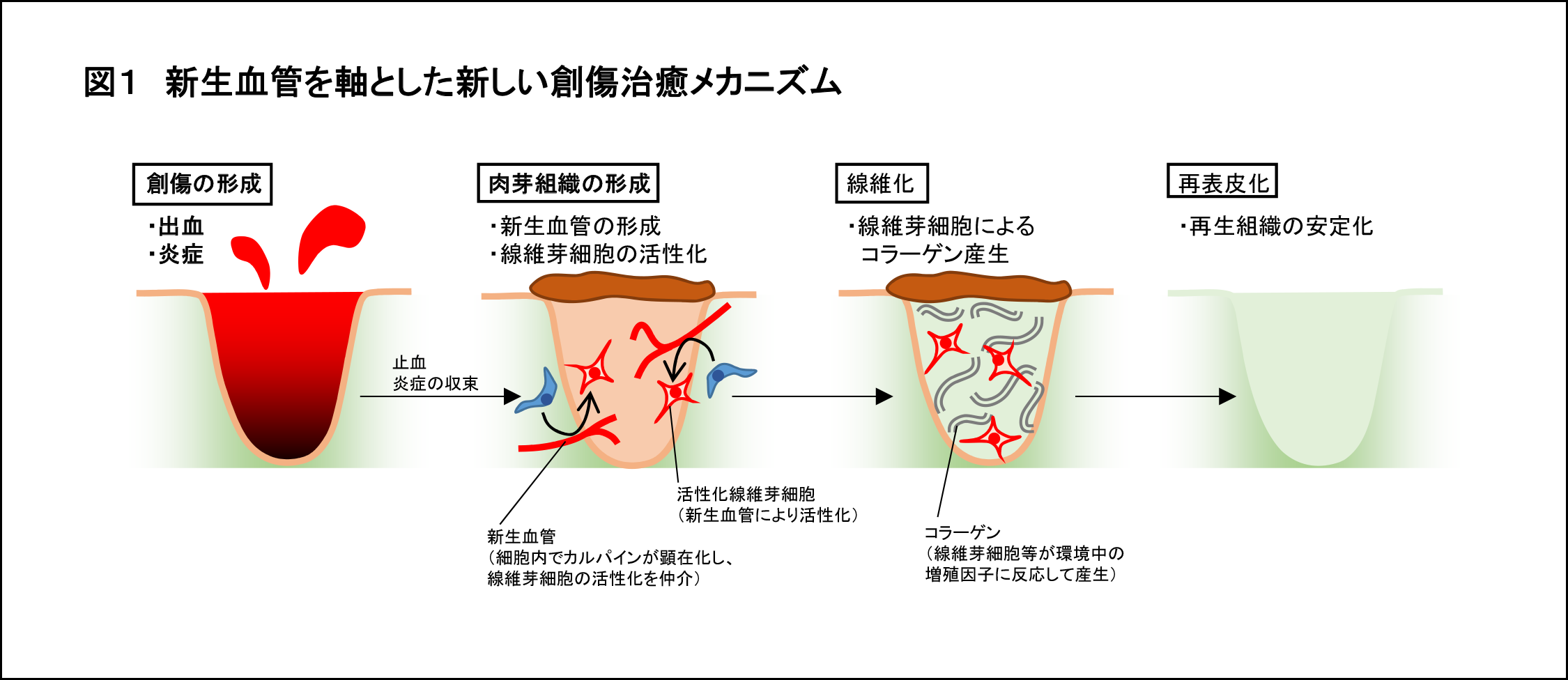 傷の治癒に関する新たな仕組みを解明 -- 毛細血管が皮膚の修復をコントロールする -- 昭和大学