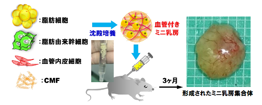 世界初、高い生着率の血管付きミニ乳房を再構築 — インプラント等に代わる新たな乳房再生医療へ期待 — 大阪大学
