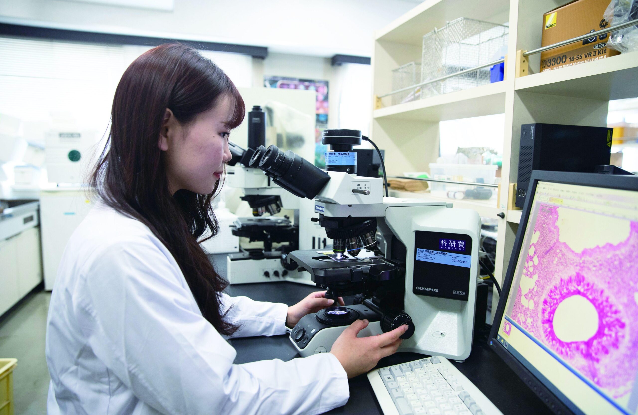 ステロイドの効かないぜんそく治療に新知見 「ＪＡＫたんぱく質」に着目