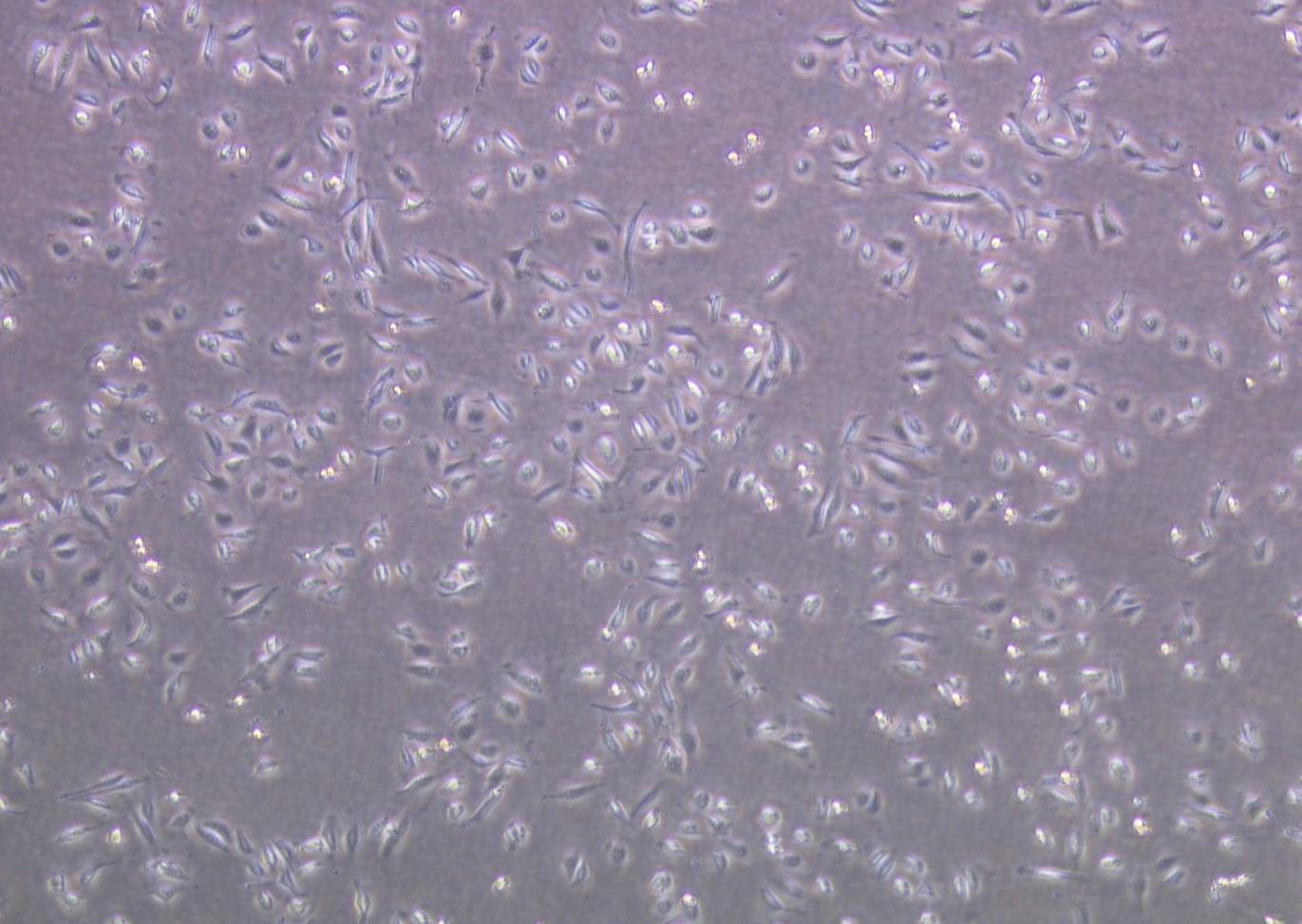 悪性度の高い前立腺がんを診断する新たな高感度測定法を確立