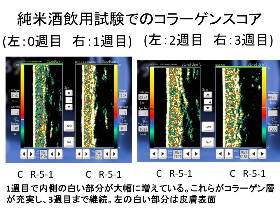 金沢工業大学尾関健二研究室と株式会社車多酒造の研究グループが、世界初、日本酒の旨味成分「α-EG」が皮膚真皮層のコラーゲン量を増やすことを学術的に実証