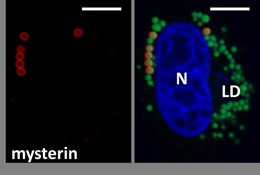 もやもや病の責任遺伝子が脂肪代謝の制御因子であることを発見 — 京都産業大学