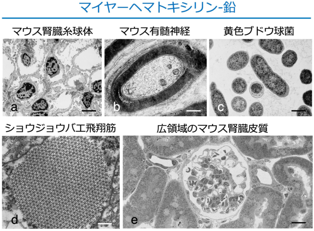 新たな電子顕微鏡試料の染色法を開発 — 安全性、コスト、扱い易さなどに優れた手法として期待 — 東京工科大学応用生物学部