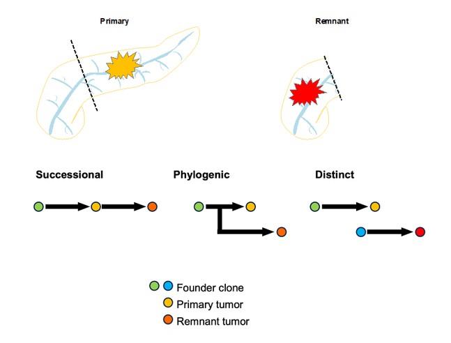 【東京医科大学】切除後の残膵がんにおける先行膵がんとの分子異常プロファイル比較から残膵がん発生様式を解明　～ 効果的な残膵がん診断治療戦略構築を目指して～